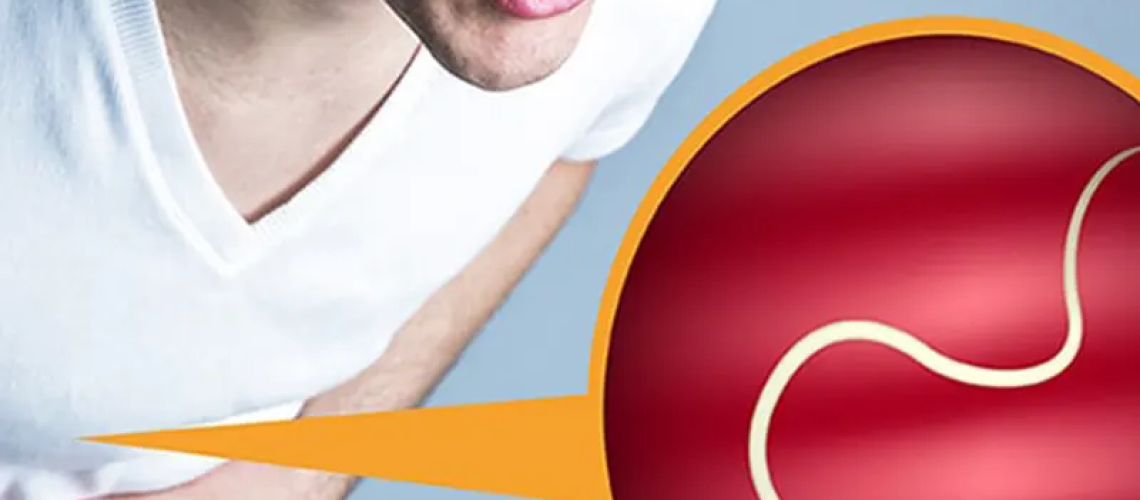 دکتر انگل روده در تهران